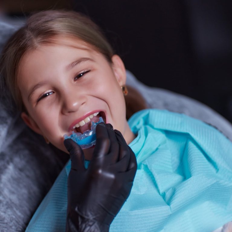 Mouth,Guard,-,Myofunctional,Trainer,To,Eliminates,Mouth,Breathing,Habit,