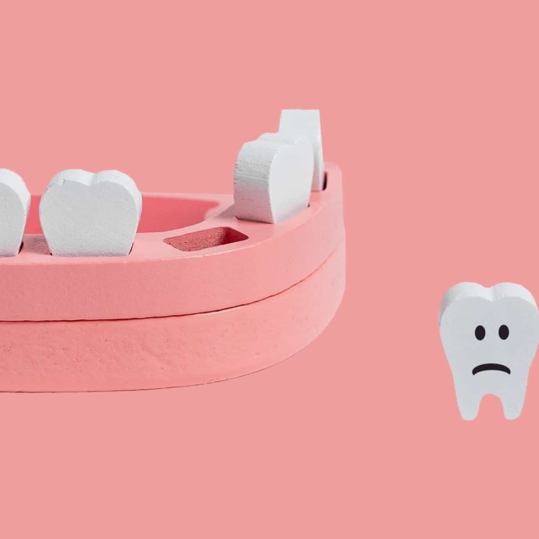 Teeth,Loss,Concept.,Wooden,Jaw,Model,With,Missing,Or,Extracted