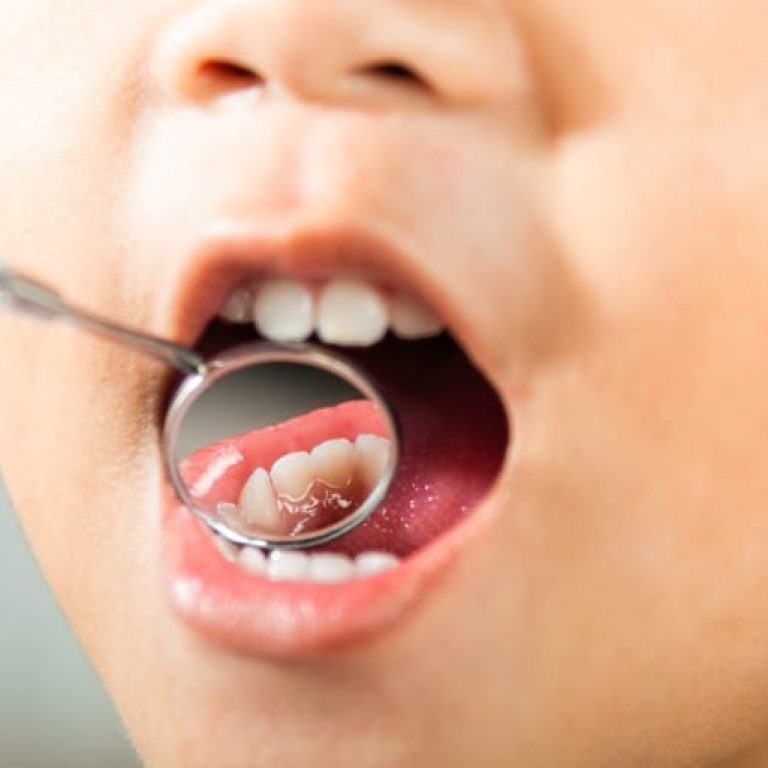 Dental,Kid,Health,Examination.,Doctor,Examines,Oral,Cavity,Of,Little