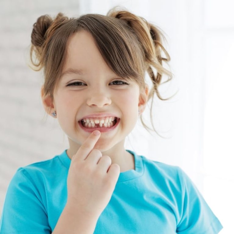 The,Kid,Lost,A,Tooth.,Baby,Without,A,Tooth.,Portrait