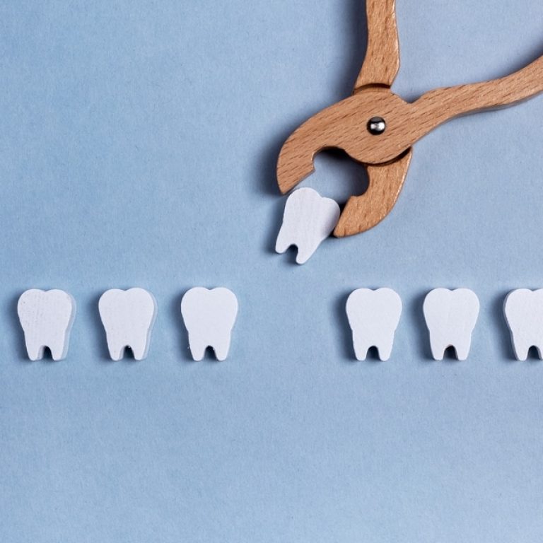 Surgical,Tooth,Extraction,,Removal,Procedure,With,Forceps.,Decayed,Root,,Gum