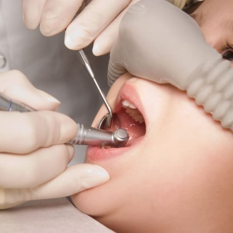 Dentist,Performs,A,Procedure,Of,Care,For,Teeth,Of,Child