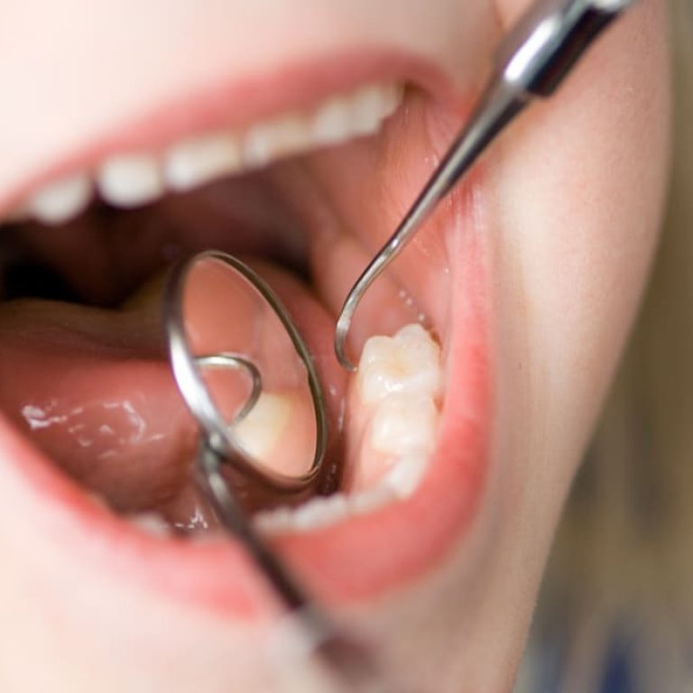Dentist,Inspecting,A,Child's,Teeth