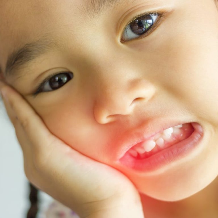 Asian,Kid,Have,Dental,Problems.